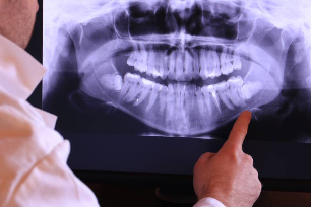 Best Emergency Root Canal Treatment in Sudden Valley, WA